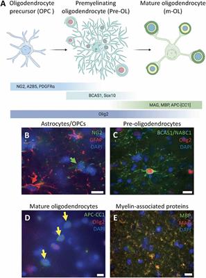 Ultrastructural Characterization of Human Oligodendrocytes and Their Progenitor Cells by Pre-embedding Immunogold